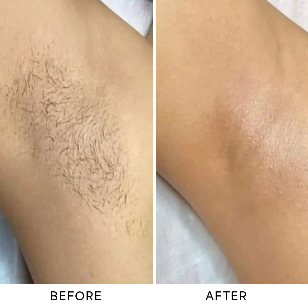 Lunivo™ SmoothShave Pro